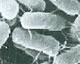 サルモネラ属菌画像
