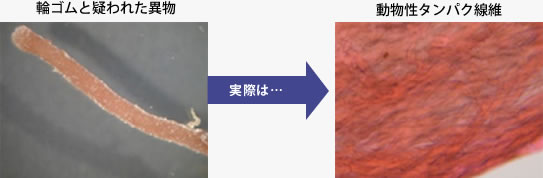 輪ゴムと疑われた異物事例画像